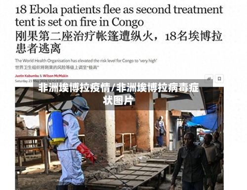 非洲埃博拉疫情/非洲埃博拉病毒症状图片-第2张图片